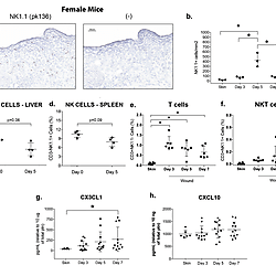 Supplementary Figures and Data - Role of NK Cells in Skin Wound Healing of Mice