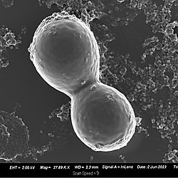Analysis of the antifungal activity and bioactivity of gold nanoparticles conjugated with Os-C(W5)