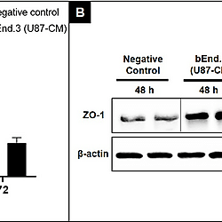 Effects of glioblastoma cells and conditioned media on brain endothelial cells in vitro