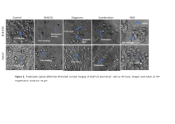 The investigation of the effects of MAZ-51 and zingerone on melanoma cell proliferation