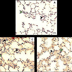 The in vitro and in vivo effect of a chemokine inhibitor CTCE-9908 in combination with Kynurenine metabolites on tumour adhesion