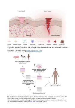 Development of a functional  acellular dermal scaffold (ADS) using 3D bioprinting to address challenges in secondary intent wound care
