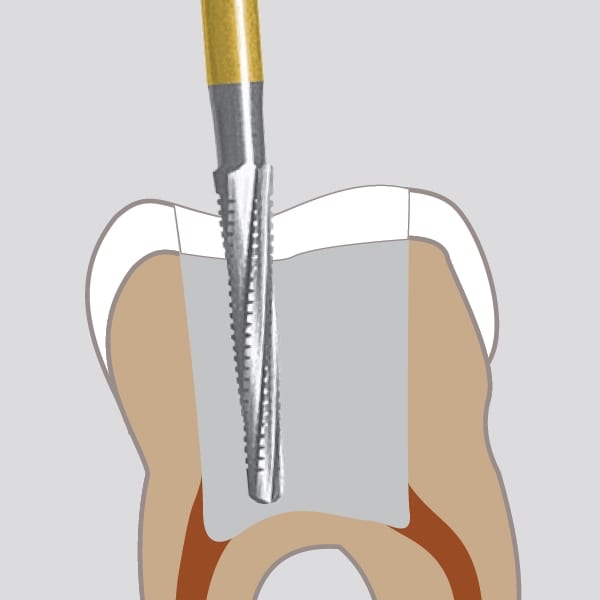 Edenta Endo Access Burs C269GKS FG Premium Plus
