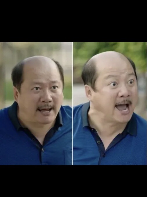 我笑不活了😂，他摘下帽子的我那一刻太秃然了