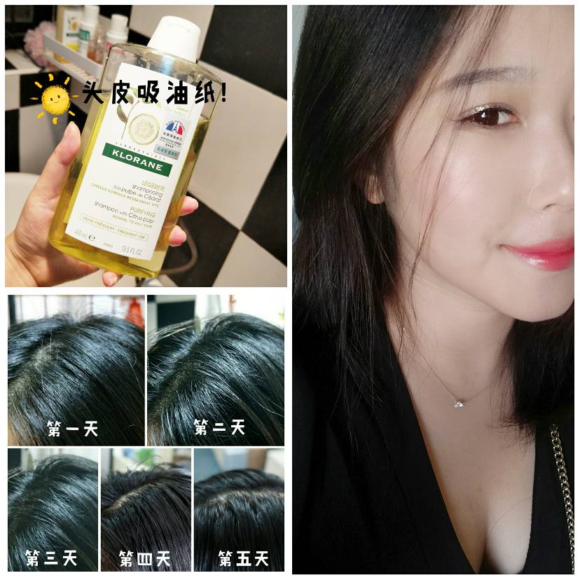 夏日头皮吸油纸，5天不洗头挑战