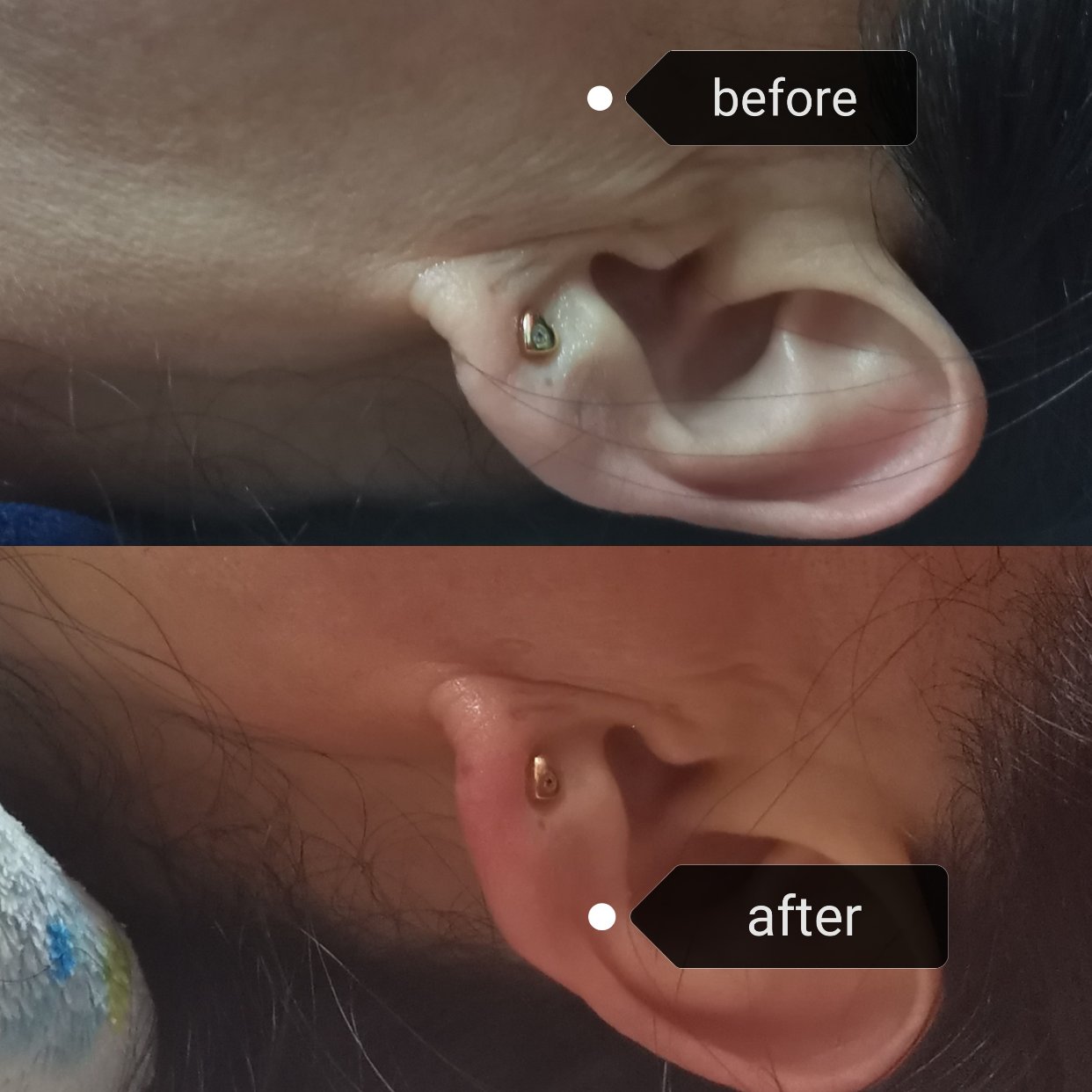 tripollar stop打卡：day8