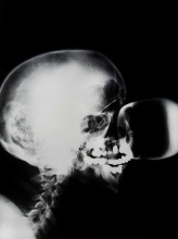 Isa Genzken, X-Ray, 1991, foto, 100 x 80 cm, particuliere collectie, foto Gert Jan van Rooij