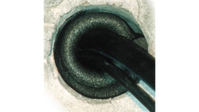 Element Centrujący, Kz20, 20Mm/1000Mm, 143490