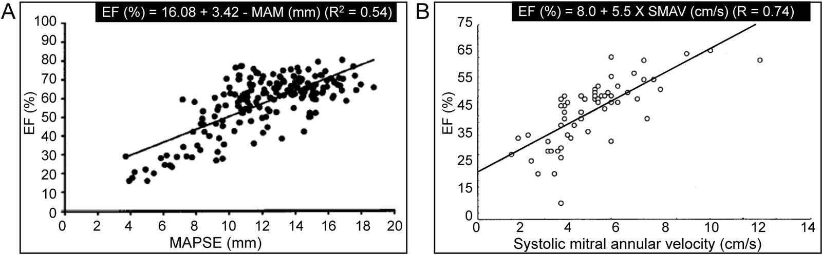 LV function indices. These scatter plot graphs show the relationship between LVEF, MAPSE and SMAV.<em> Abbreviations</em>: EF, ejection fraction; LVEF, left ventricular ejection fraction; MAM, mitral annular motion; MAPSE, mitral annular plane systolic excursion; R, correlation coefficient; SMAV, systolic mitral annular velocity. Source: Adapted with permission from Emilsson <strong><sup>319</sup></strong> and Alam et al. <strong><sup>320</sup></strong>