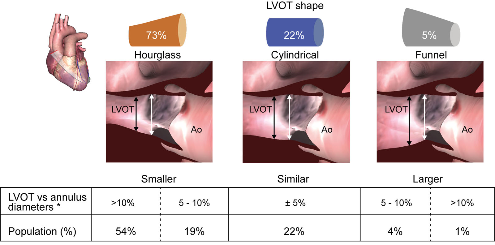 Prevalence of different LVOT shapes and their effect on SV estimation. This figure shows the prevalence of different LVOT shapes in our population along with examples (zoomed ME LAX echocardiographic images). *Bias examples: assuming a theoretical LVOT VTI of 20 cm and an AoV VTI of 80 cm, a 5% error in diameter (e.g., LVOT diameter of 20 mm corresponding to LVOT area 3.14 cm² vs LVOT diameter of 21mm and LVOT area 3.46 cm²) would yield a 10% error in SV (63 vs 69 mL) and AVA (0.79 vs 0.87 cm2). A 10% error in diameter (e.g., LVOT diameter of 20 mm corresponding to LVOT area 3.14 cm2 vs LVOT diameter of 22 mm and LVOT area of 3.80 cm2) would yield a 21% error in SV (63 vs 76 mL) and in AVA (0.79 vs 0.95 cm²).<em> Abbreviations</em>: Ao,aorta; AoV, aortic valve; AVA, aortic valve area; <s>d, diameter;</s> LAX, long-axis; LVOT, left ventricular outflow tract; ME, mid-esophageal; SV, stroke volume; VTI, velocity time integral. Adapted from Guzetti et al.<strong><sup>20</sup></strong>