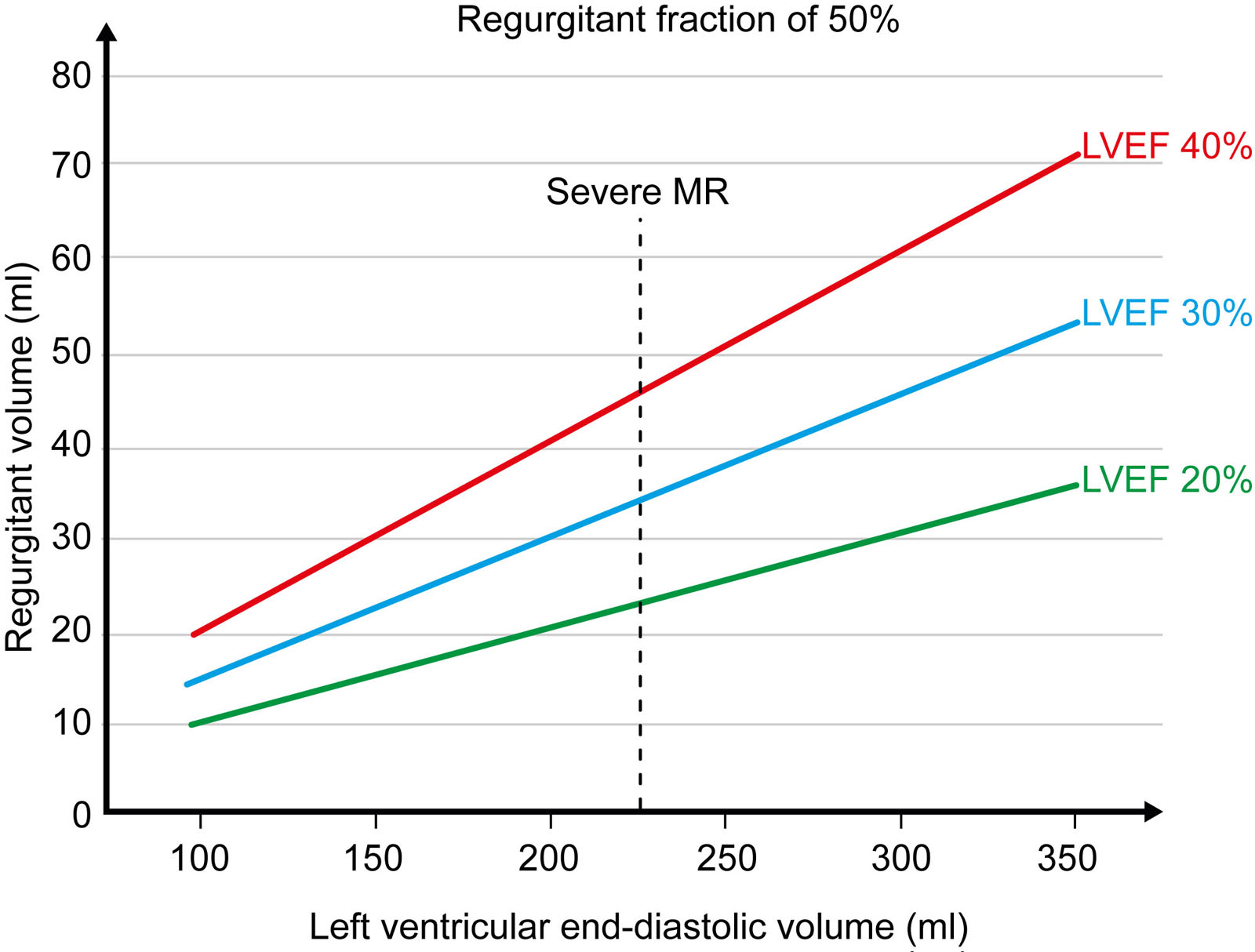 RVol and LVEF. This graph shows the variations in MV RVol versus LV end-diastolic volume at different LVEFs. The RVol changes with LVEF and never exceeds 60 ml in patients with LVEF < 30%. The RVol may exceed 60 ml in patients with LVEF > 40% only in very dilated LV (LVEDV > 300 ml). At normal LV size, RVol can be below 30 ml, even when RF is 50%. With an LVEDV of 230 ml (dotted vertical line; mean for heart failure clinical trials), severe MR by RF criteria occurs at 45 ml for an LVEF of 40%, 35 ml for LVEF 30%, and <25 ml for LVEF 20%.<em> Abbreviations</em>: LV, left ventricle; LVEDV, left ventricular end-diastolic volume; LVEF, left ventricular ejection fraction; MR, mitral regurgitation; MV, mitral valve; RF, regurgitant fraction; RVol, regurgitant volume. Adapted from Grayburn et al.<strong><sup>49</sup></strong>