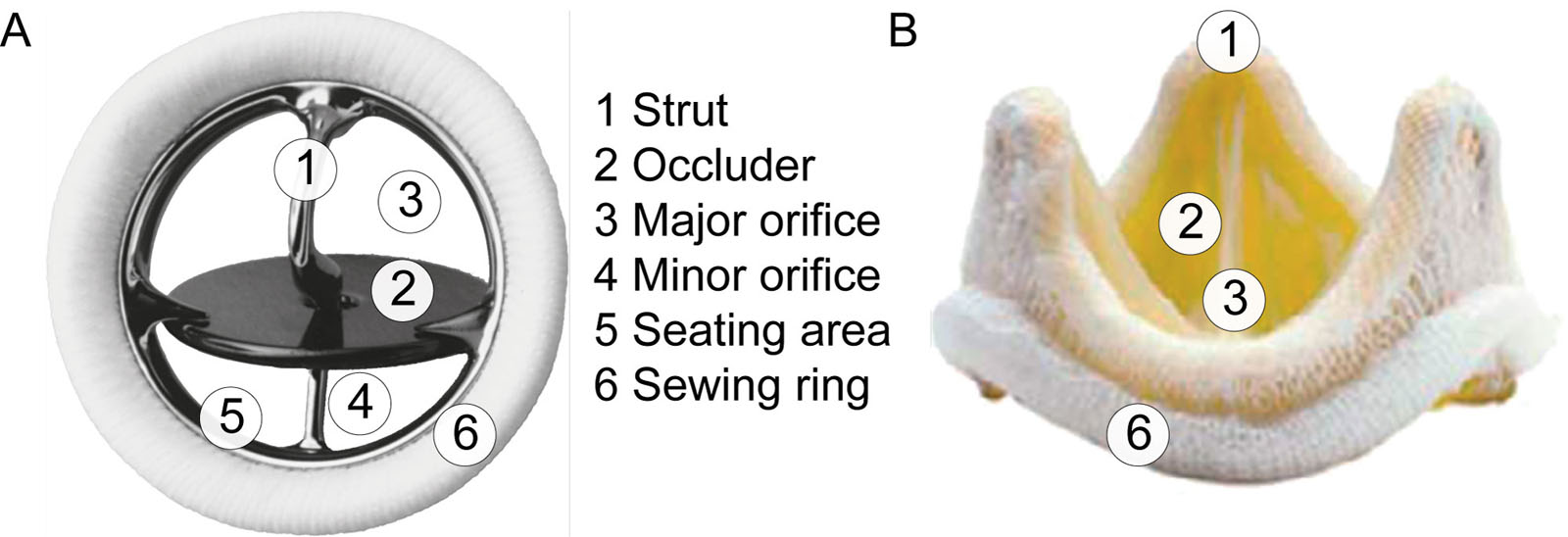 Descriptors of the prosthetic valve components. (A) Mechanical tilting disc valve (Medtronic Hall, U.S.). (B) Bioprosthetic Epic™ Plus Mitral stented valve (Abbott, U.S.).