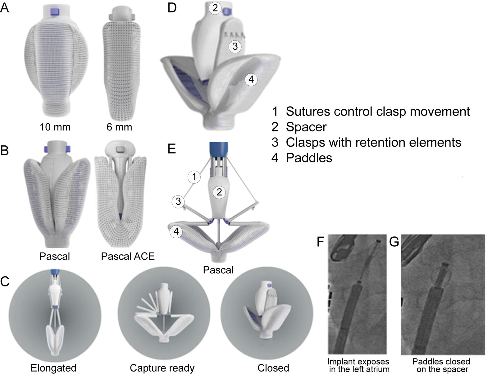 PASCAL® device. (A-G) These are photos of the different components and function of the Precision Transcatheter Valve Repair System (Edwards Lifesciences, Irvine, CA). Source modified from Whisenant et al. <sup>104</sup>