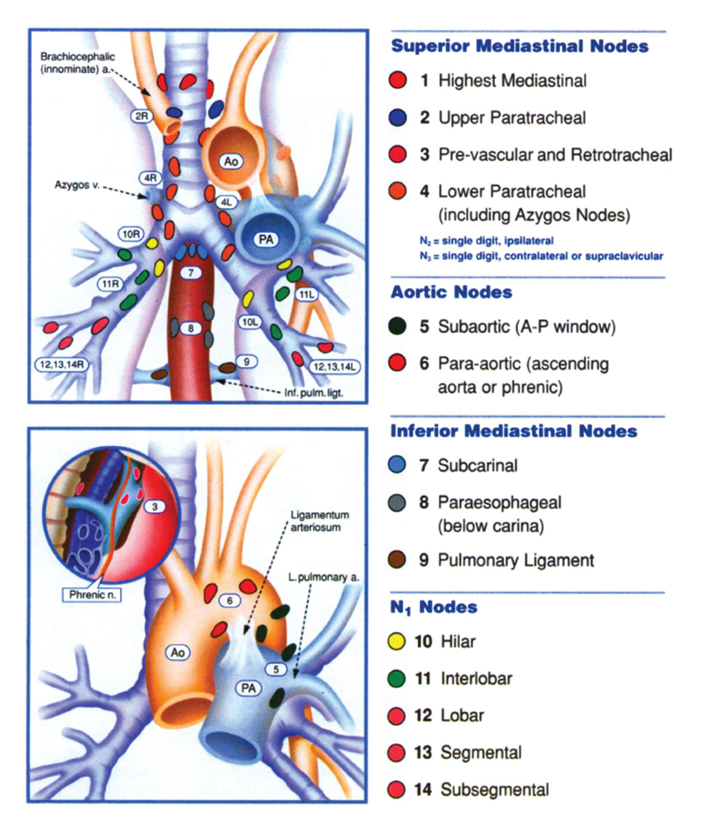 Mediastinal lymph nodes. This is a diagram of the mediastinal lymph node stations for lung cancer staging.<em> Abbreviations</em>: a, artery; A, anterior; Ao aorta; inf, inferior; L, left; ligt, ligament; n, nerve; P, posterior; PA, pulmonary artery; pulm, pulmonary; v, vein. Source: With permission of Mountain CF et al.<strong><sup>32</sup></strong>