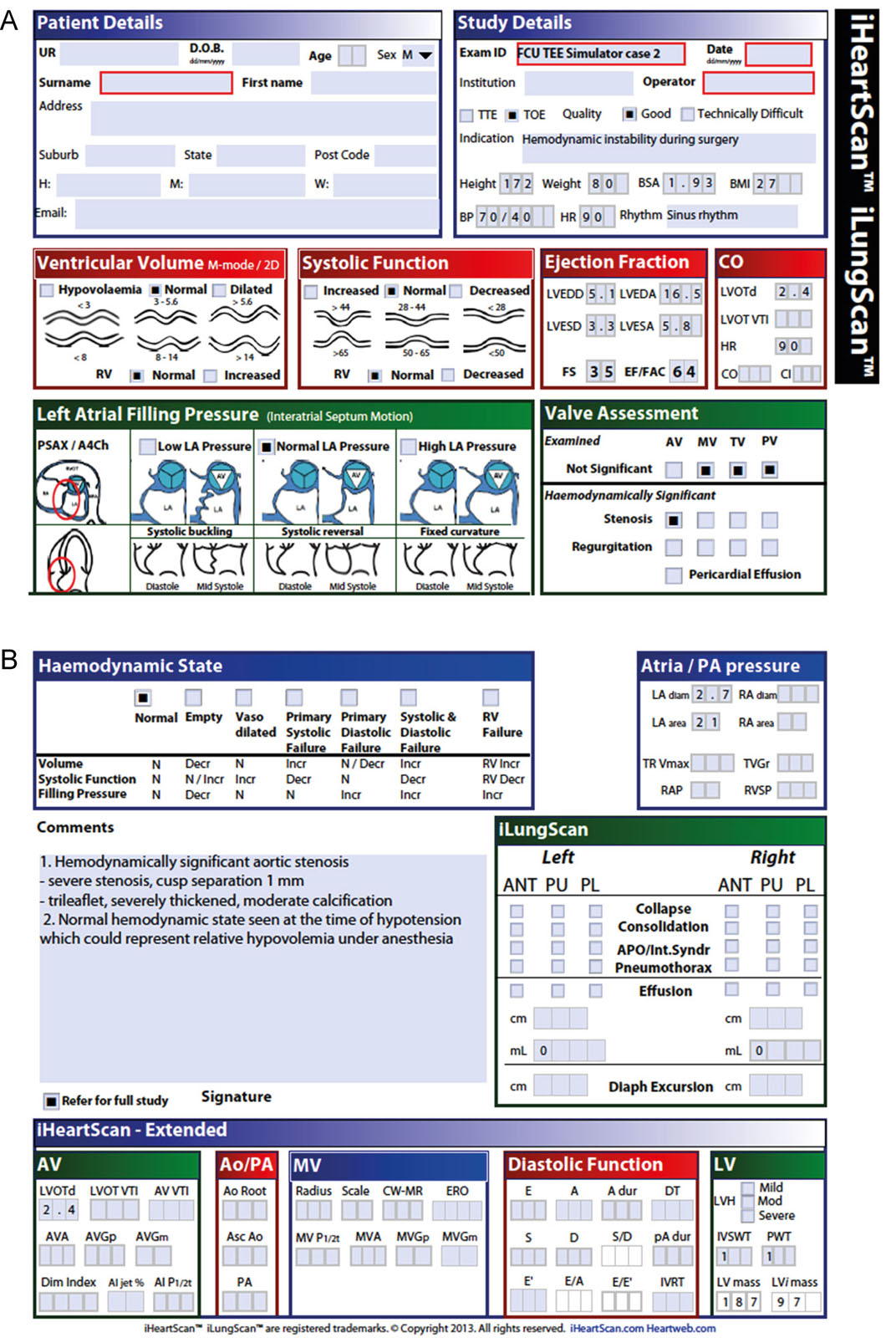 iTeachU Focused Cardiac Ultrasound TEE and TTE course. (A,B) Format of the interpretive report which includes the patients and study details, assessment of ventricular function, filling pressure, valves, hemodynamic state, lung scanning and extended iHeartScan. Courtesy of iEachU David Canty, Melbourne University, Australia.
