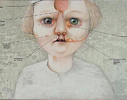 Gemeines-Kind