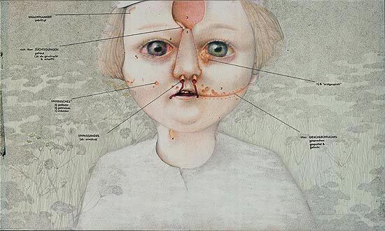 Gottfried Helnwein | WORKS | Drawings | Gemeines Kind (Mean Child)
