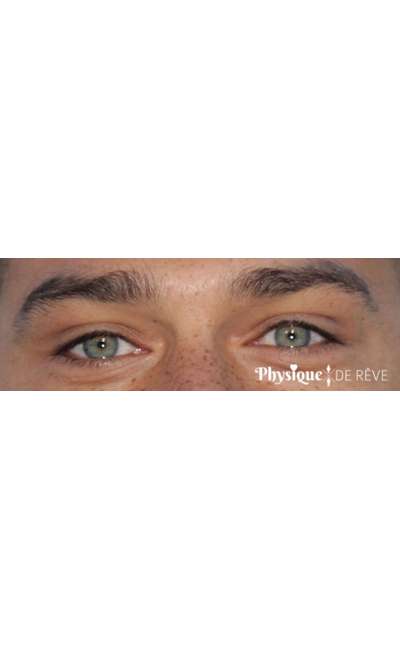 Image de couverture de Réponse à "Décrivez moi votre ressenti lorsque vous voyez la personne que vous aimez"