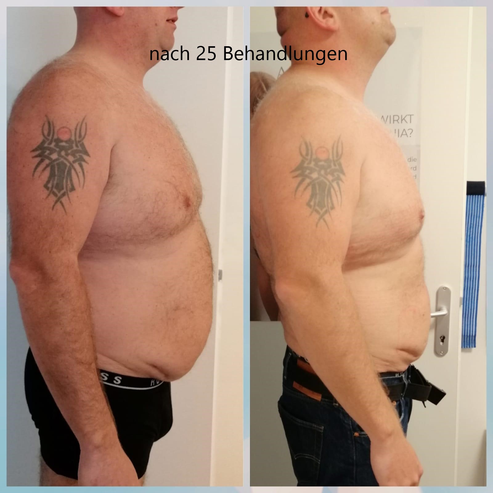 Abnehmen im Liegen Reutlingen Sonnenstraße, Sonnenstraße in Baden-Württemberg - Reutlingen