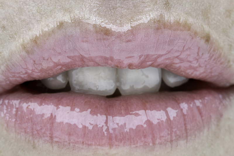 CATRIN AND JACOB, Rykestraße in Berlin