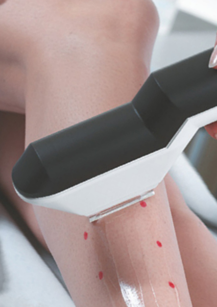 Ästhetik mit Haut&Haar, Berliner Straße in Hilden