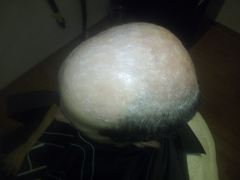 Haarsysteme Laterra, Untere Badgasse in Altdorf