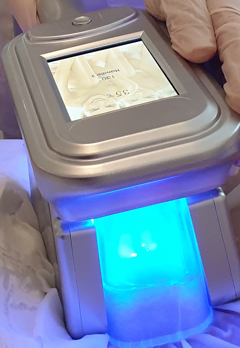 Kryolipolyse ( Coolsculpting ) statt Fettabsaugen - Fettabsaugung oder Fett-weg-Spritze Potsdam / Berlin - Zehlendorf, Charlottenstraße in Potsdam