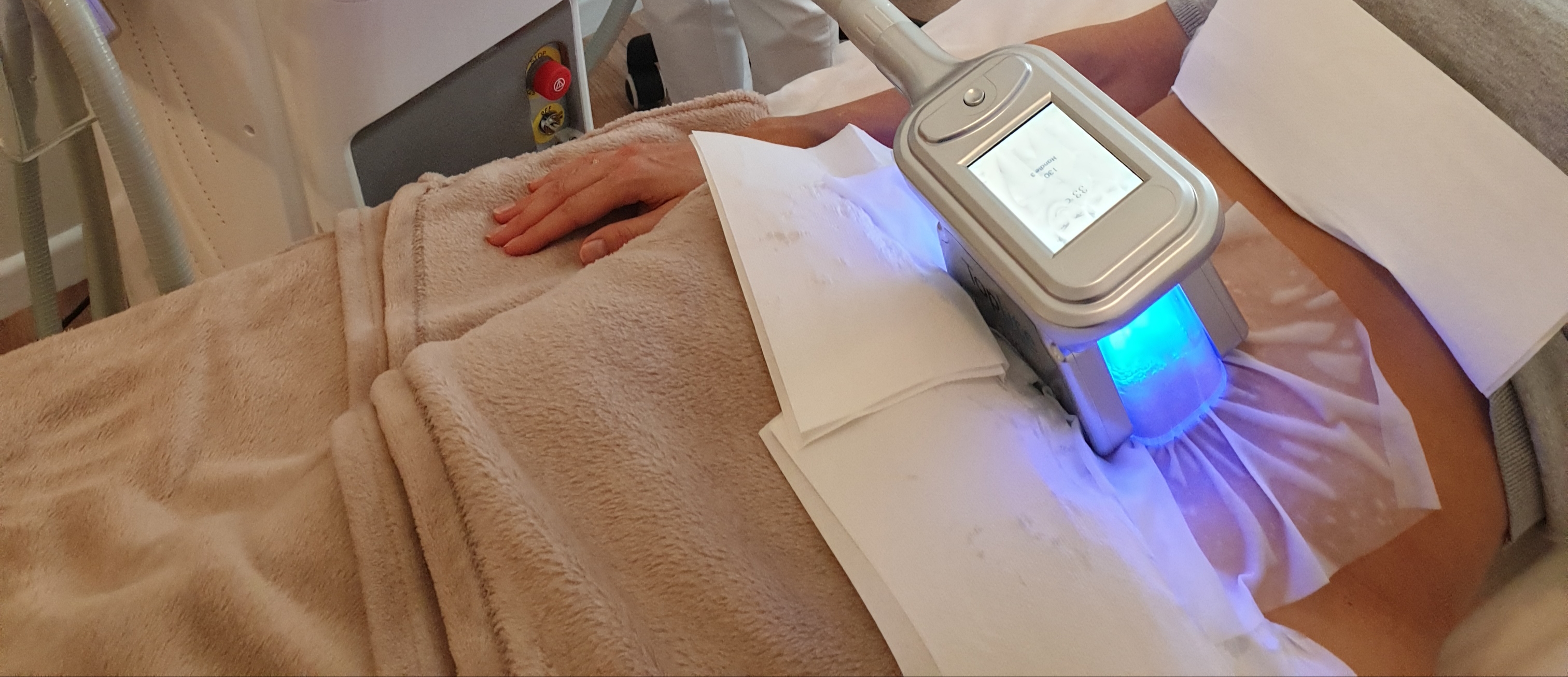 Kryolipolyse ( Coolsculpting ) statt Fettabsaugen - Fettabsaugung oder Fett-weg-Spritze Potsdam / Berlin - Zehlendorf, Charlottenstraße in Potsdam