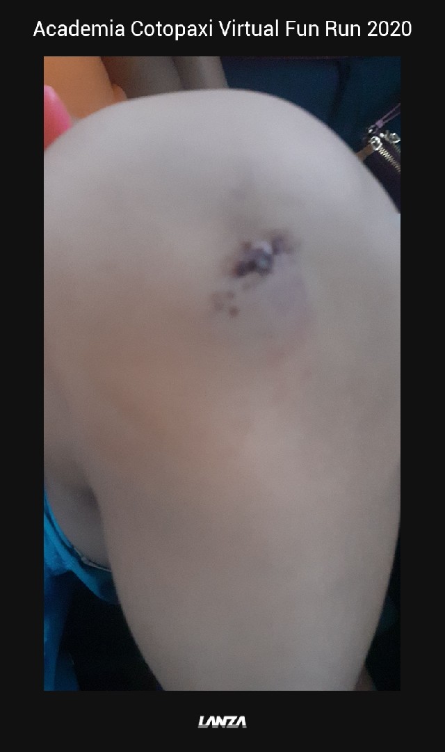 CESAR ERWIN ZAPATA GUIJARRO