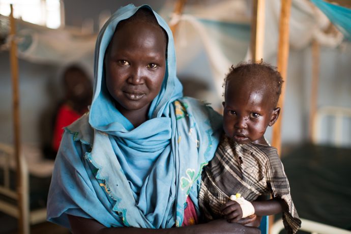 Maban County Hospital is the only medical facility offering surgical care in the state.