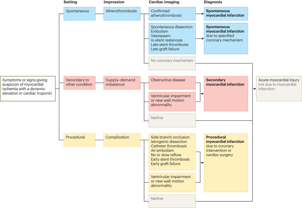 A new clinical classification of acute myocardial infarction Resea