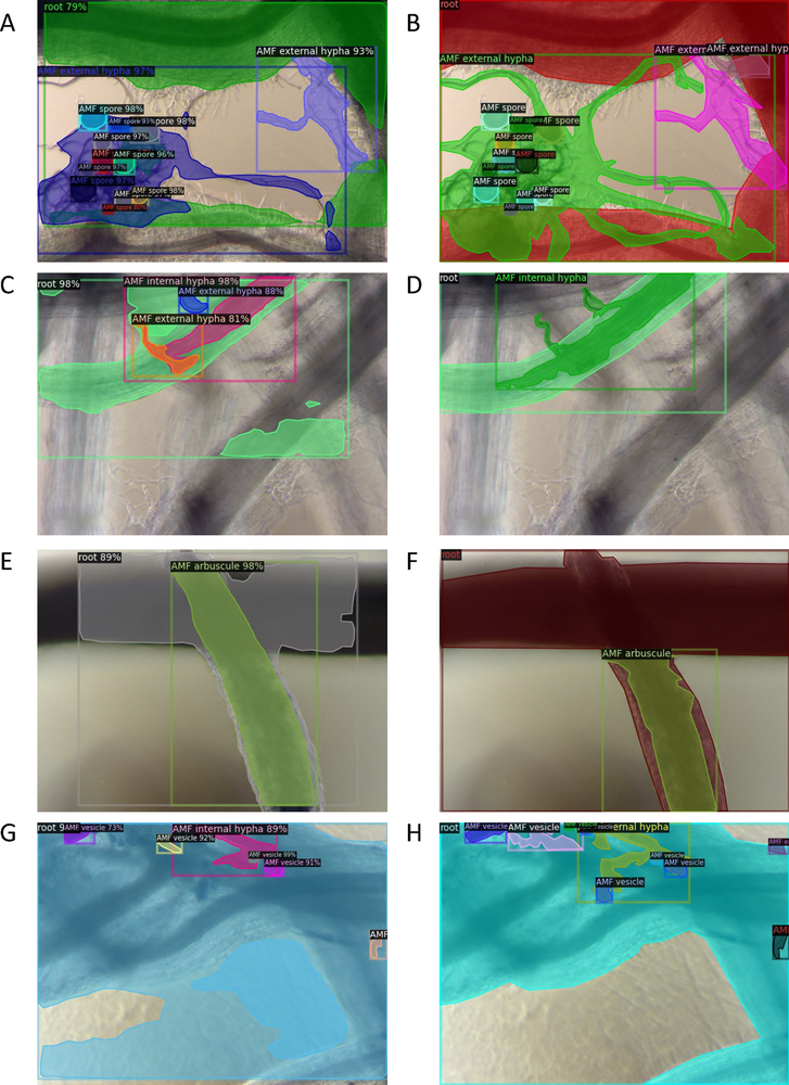 Computer vision models enable mixed linear modeling to predict arbus