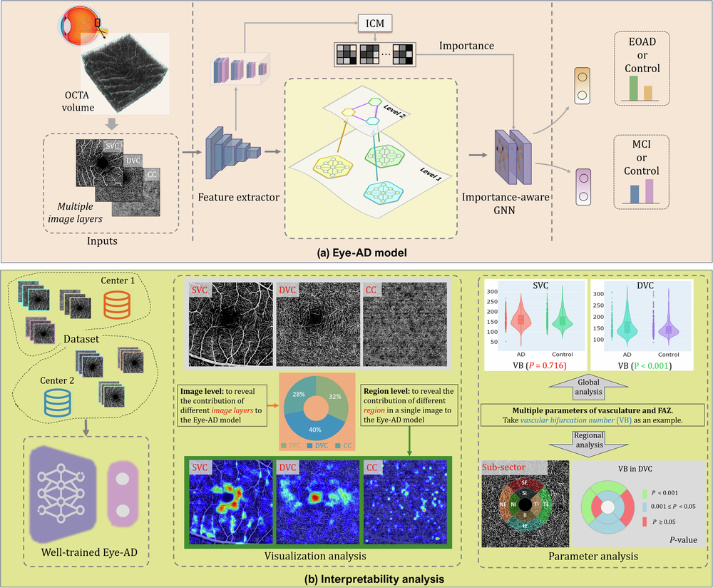 Early detection of dementia through retinal imaging and trustworthy