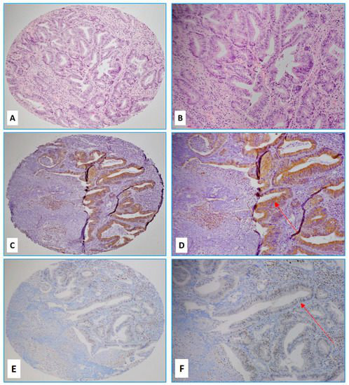 hpv gardasil vis sheet