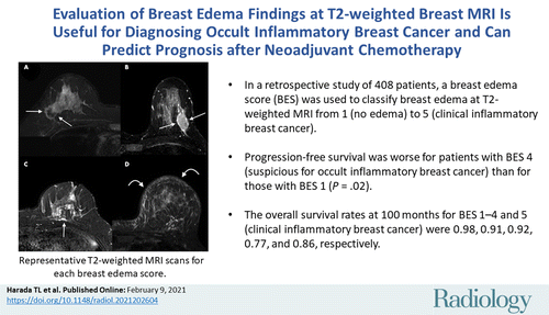 Evaluation Of Breast Edema Findings At T2 Weighted Breast Mri Is Useful For Diagnosing Occult Inflammatory Breast Cancer And Can Predict Prognosis After Neoadjuvant Chemotherapy Researcher An App For Academics