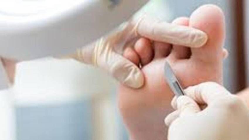 Immagine: Podologia a domicilio
