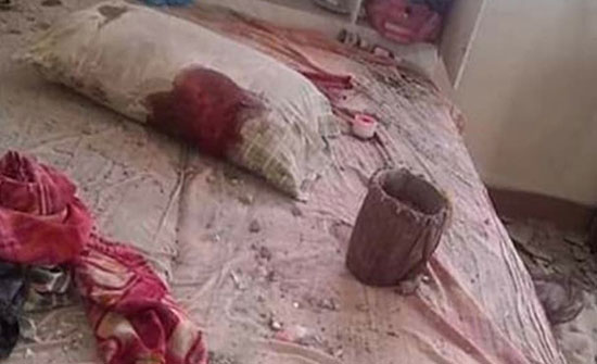 مقتل امرأة وإصابة 3 أشخاص بقصف الحوثيين العشوائي لتعز مقتل امرأة وإصابة 3 أشخاص بقصف الحوثيين العشوائي لتعز