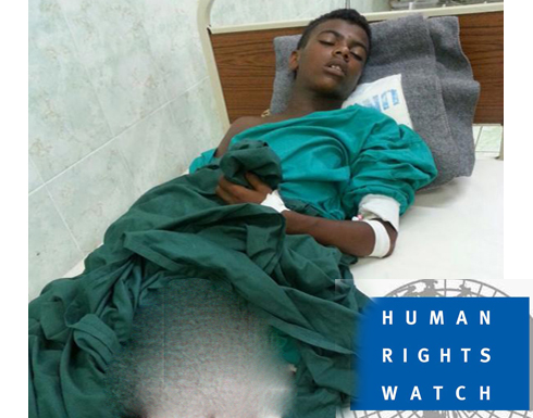 "هيومن رايتس ووتش": على الحوثيين وصالح وقف استخدام الألغام المحظورة