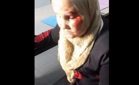 بالفيديو : بعد اعتدائه على ابنتها..معلم يعتدي يشوه وجه سيدة بالفيديو : بعد اعتدائه على ابنتها..معلم يعتدي يشوه وجه سيدة