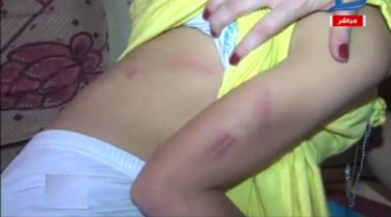 «شاهد» طفلة مصريّة (10 سنوات) دخلت محلاً وطلبت ماءً للشرب فخرجت مغتصبةً .. وهذه روايتها «شاهد» طفلة مصريّة (10 سنوات) دخلت محلاً وطلبت ماءً للشرب فخرجت مغتصبةً .. وهذه روايتها