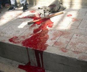 قطع يد غريمه بعد خلاف حول عشيقتهم المتزوجة