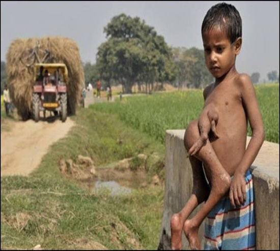 صور| شاهدوا ماذا حصل مع هذا الطفل "الشيطان" كما أسموه!