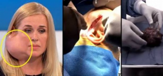 بالفيديو: كانت تعاني انتفاخاً في وجهها.. شاهد ماذا وجد الأطباء!