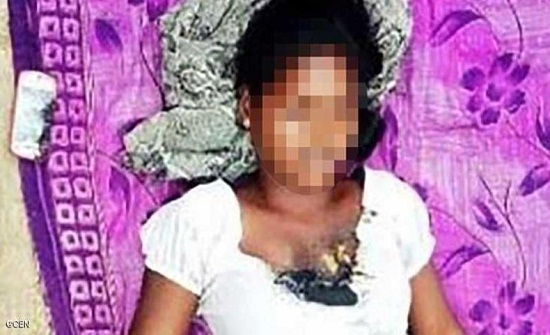 انفجار هاتف محمول بوجه فتاة يودي بحياتها انفجار هاتف محمول بوجه فتاة يودي بحياتها