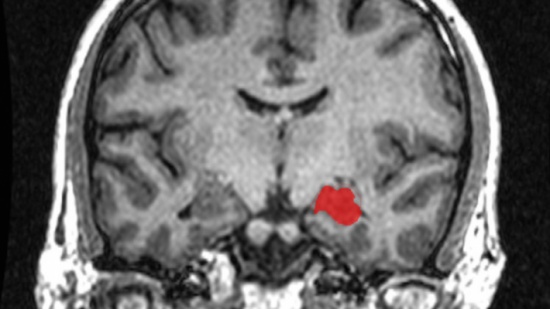 جراحة تقوي العاطفة لدى مريضة !