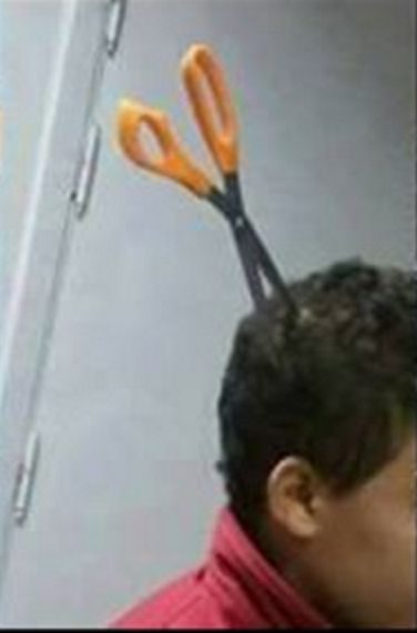 بالصور.. أم تغرز مقص في رأس ابنها بالصور.. أم تغرز مقص في رأس ابنها
