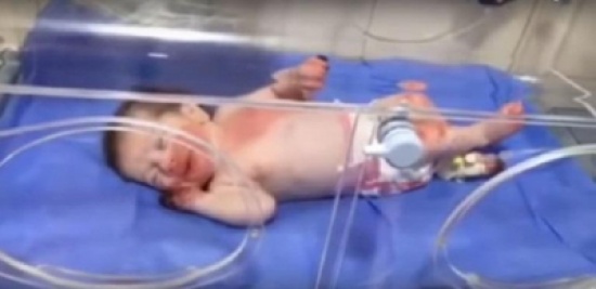 أمريكية تقطع 10 آلاف كيلومتر لتبني الطفلة العراقية "المعجزة" أمريكية تقطع 10 آلاف كيلومتر لتبني الطفلة العراقية "المعجزة"