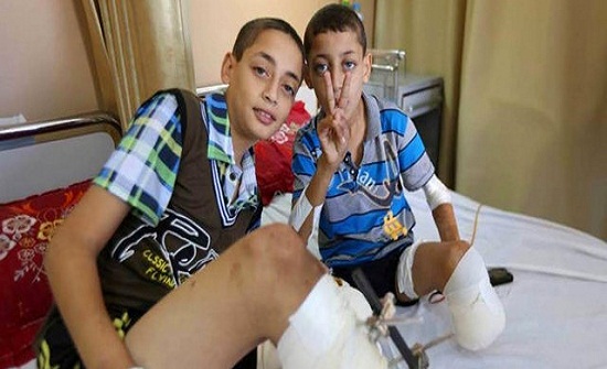 39 شهيدا و 5000 جريح حصيلة اعتداء الاحتلال على مسيرة العودة 39 شهيدا و 5000 جريح حصيلة اعتداء الاحتلال على مسيرة العودة