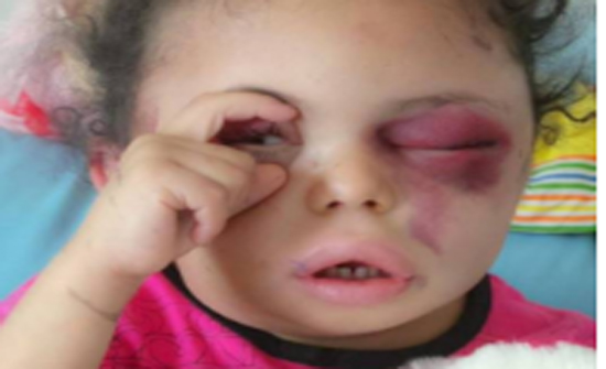 فيديو مؤثر - الطفلة بثينة الناجية الوحيدة من أسرتها تشعل مواقع التواصل بحركة يدها!