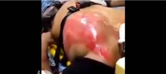 فيديو| شاب شرب أكثر من 20 علبة مشروب طاقة.. شاهد ماذا حصل لـ قلبه!